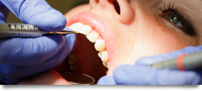 A person being checked for signs of gum diease by their dentist.